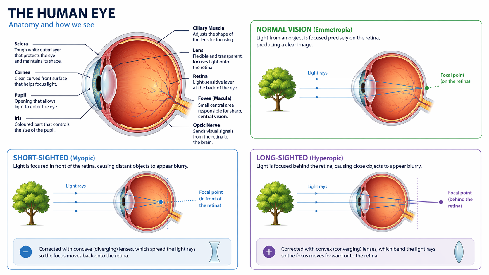 myopic-hyperopic-diagram