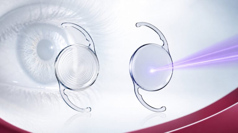 implantable-trifocal-vs-light-adjustable-lenses
